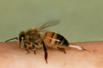 Użądlenie powodem śmierci?